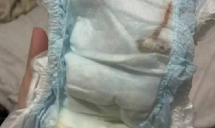 Mãe encontra rato morto na fralda de bebê