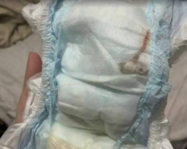 Mãe encontra rato morto na fralda de bebê